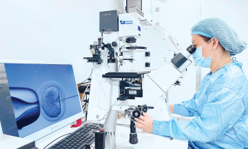 Ovarian endometriosis cyst causes secondary infertility