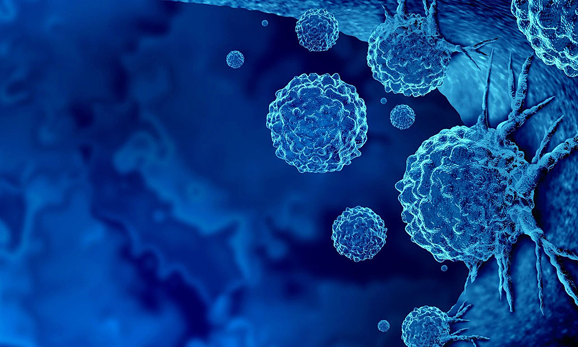 Russian scientists create cancer-killing virus that spares healthy cells
