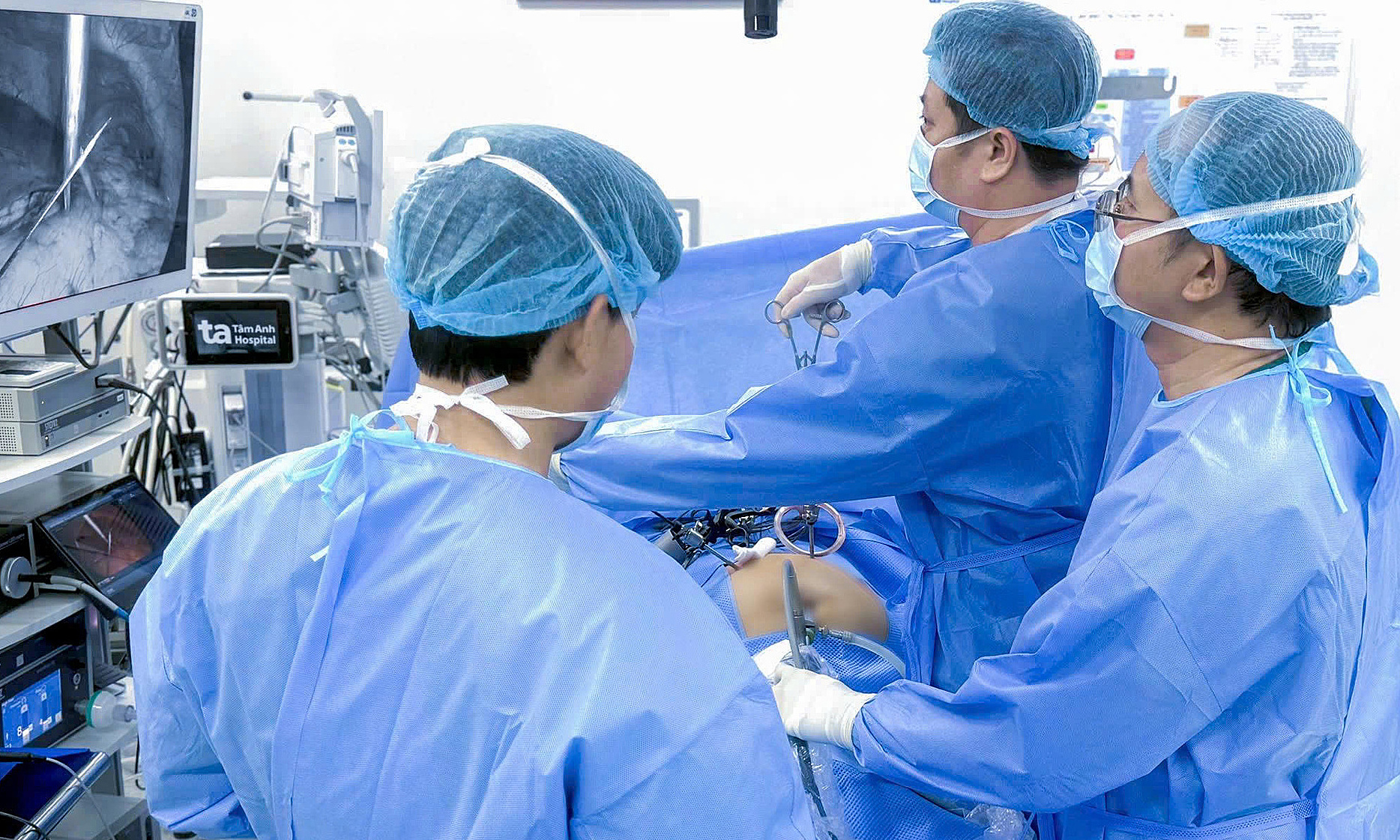 Fish bone embedded in man's liver