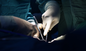 Shortness of breath reveals metastatic prostate cancer in lungs
