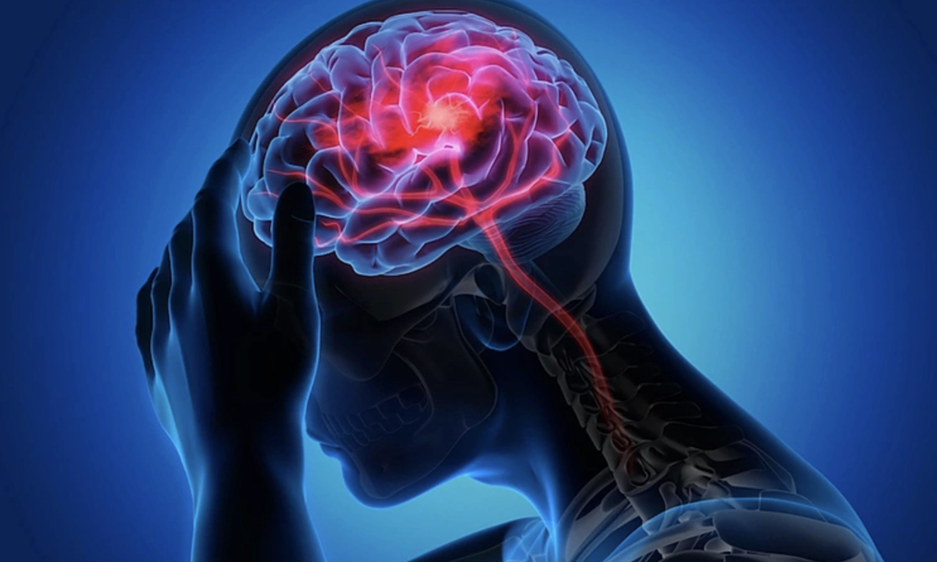 US doctors identify seven habits to avoid to prevent stroke