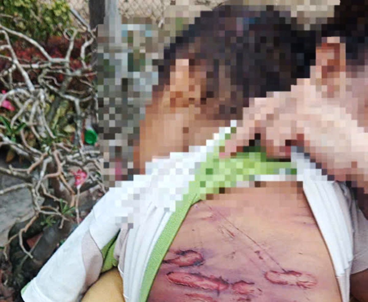 2-year-old boy suffers multiple injuries from abuse by mother and her partner in Ho Chi Minh City