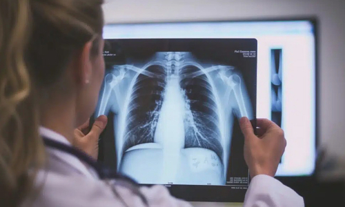 32-year-old female manager diagnosed with lung cancer despite not smoking
