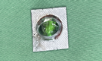 Teen suffers esophageal tear from accidentally swallowing unpeeled pill