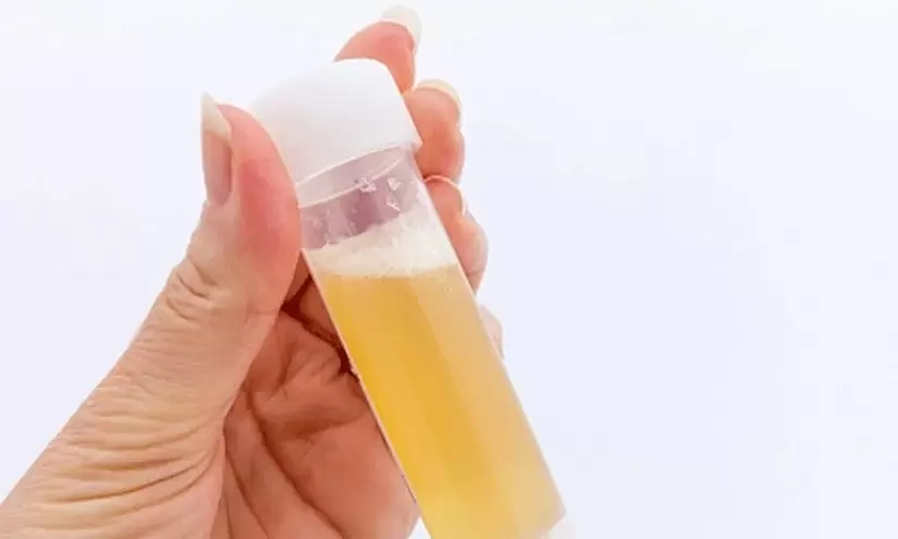 Is frequent foamy urine a sign of kidney failure?