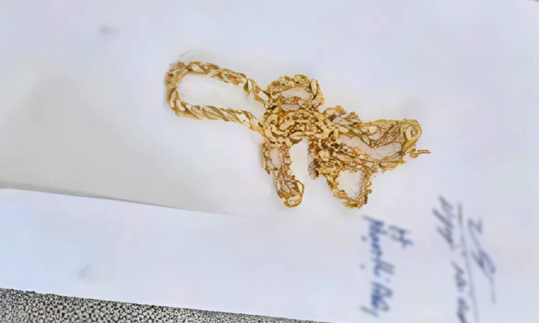 Pretended to buy 10 chicken eggs to snatch gold necklace