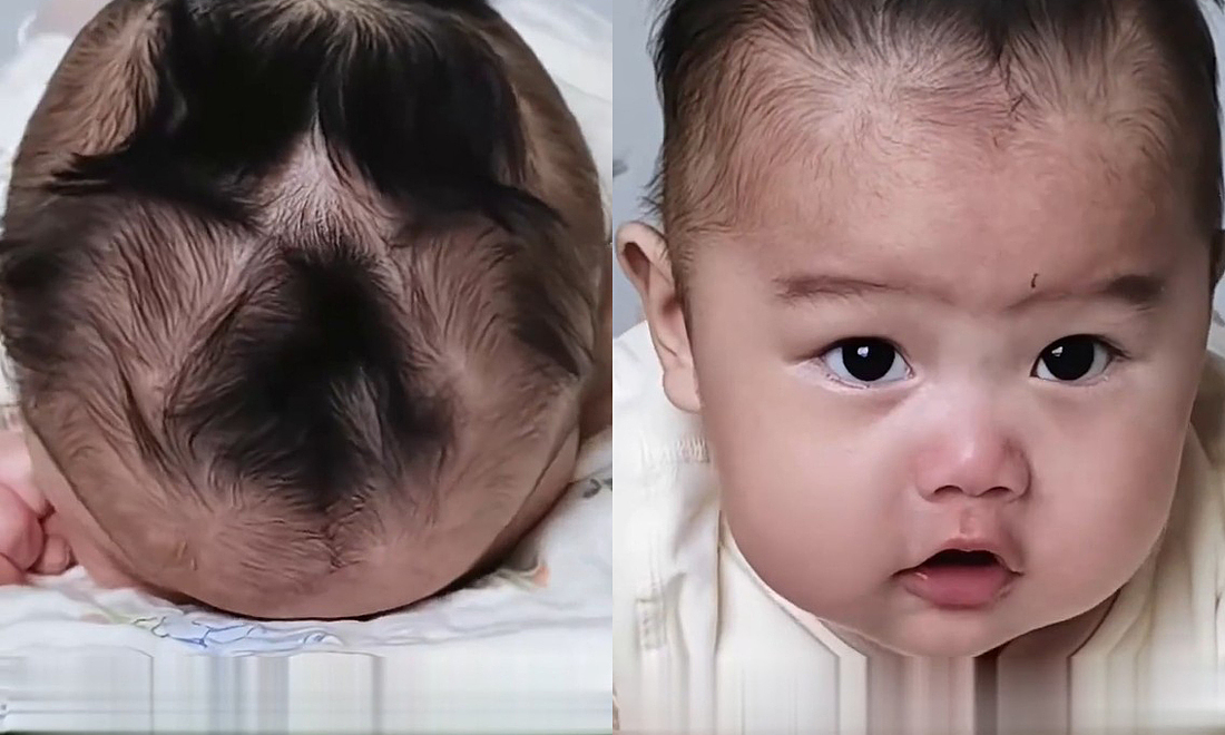 Boy with 9 rare hair whorls