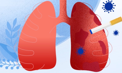 Lung cancer risk after quitting smoking