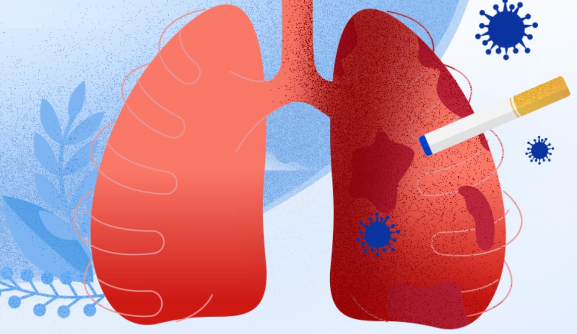 Lung cancer risk after quitting smoking