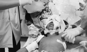 11-year-old boy severely bitten by German Shepherd