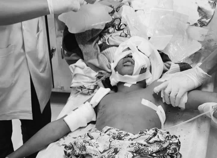 11-year-old boy severely bitten by German Shepherd