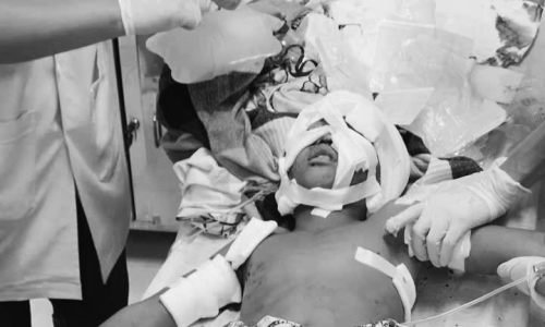 11-year-old boy severely bitten by German Shepherd
