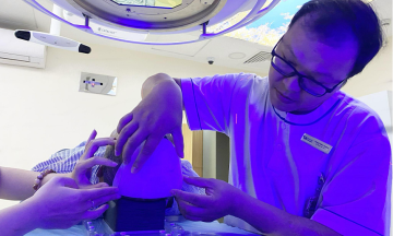 Radiation therapy for scalp cancer in a man