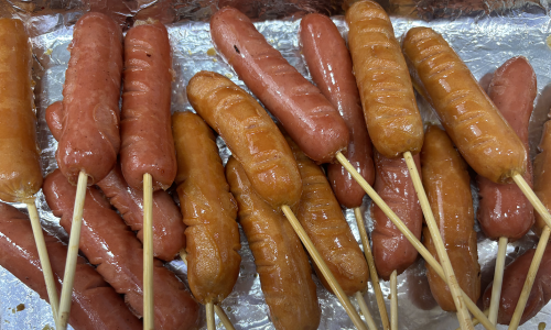 Doctor identifies 5 dietary mistakes that harm kidneys