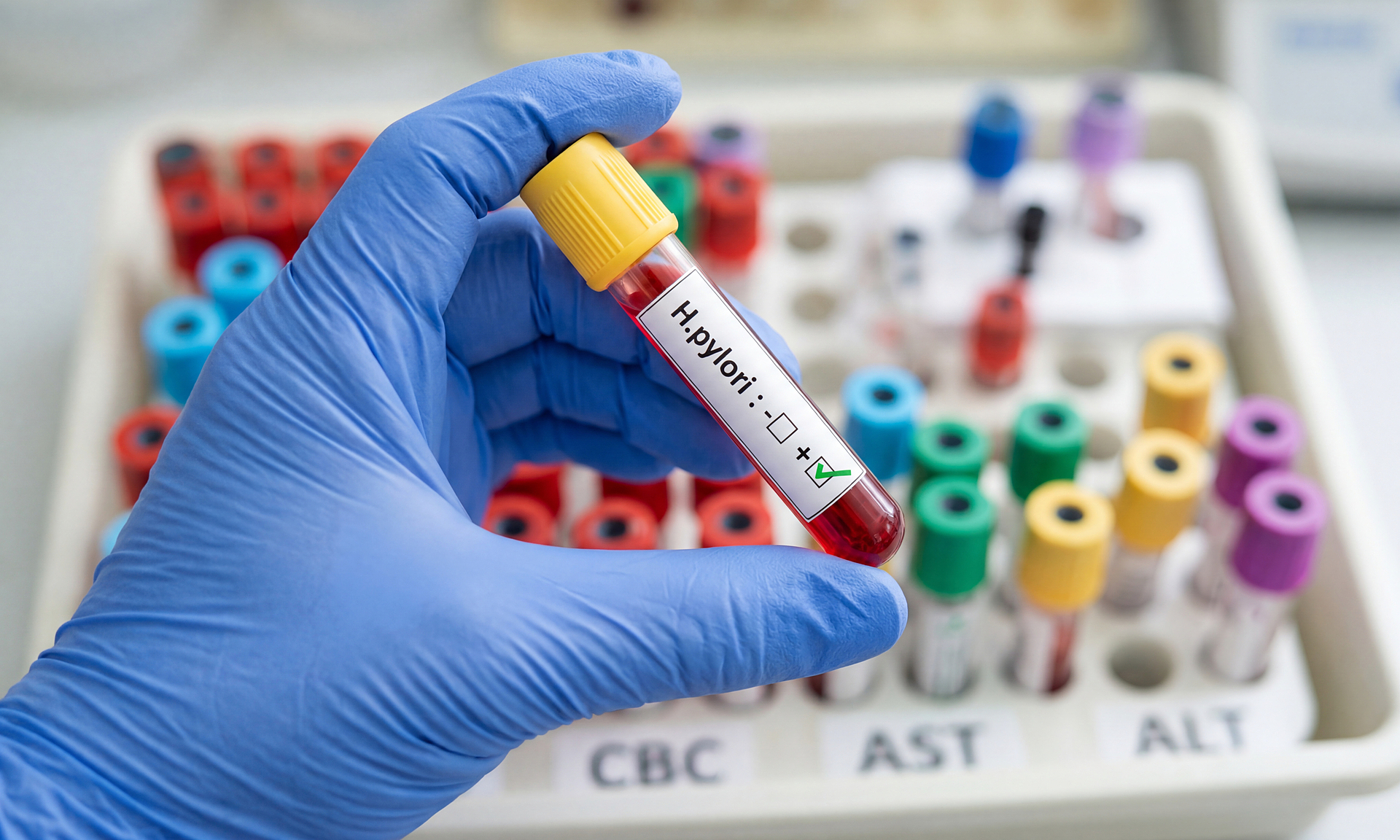 Is antibody testing necessary after hepatitis B vaccination?