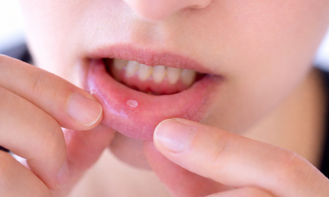 Why do non-smokers still get oral cancer?