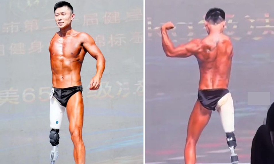 Young man with lost arm and leg competes in bodybuilding