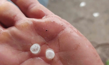 Hailstorm in Dong Nai