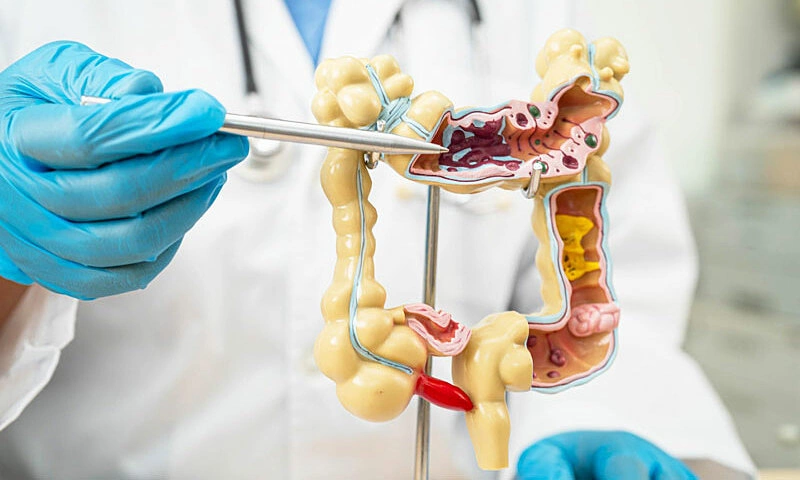 Harvard doctor warns of four easily overlooked early signs of colorectal cancer