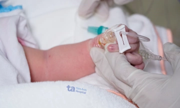 Surgery corrects three severe heart defects in newborn girl