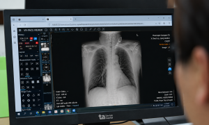 Mistaken for asthma, a 77-year-old's persistent symptoms reveal invasive lung fungus