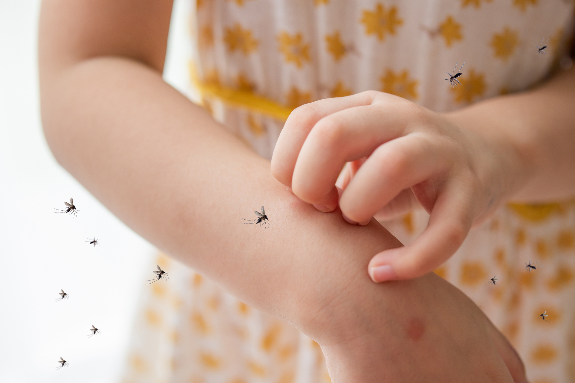 Signs of dengue fever in children