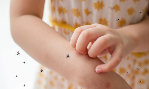 Signs of dengue fever in children