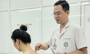 Acupuncture treats neck and shoulder pain