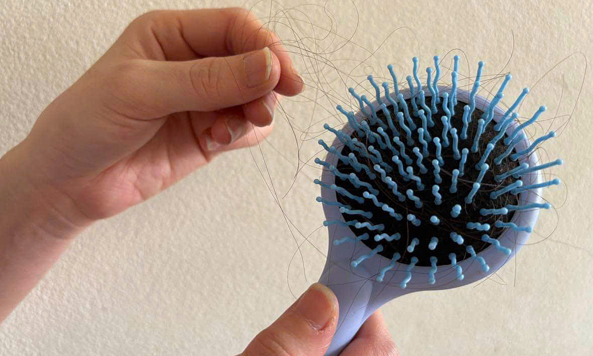 Four periods when women are prone to hair loss