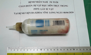 Surgery removes plastic bottle from man's rectum