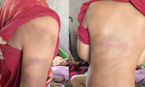 Police question father after son found bruised from bamboo stick beating