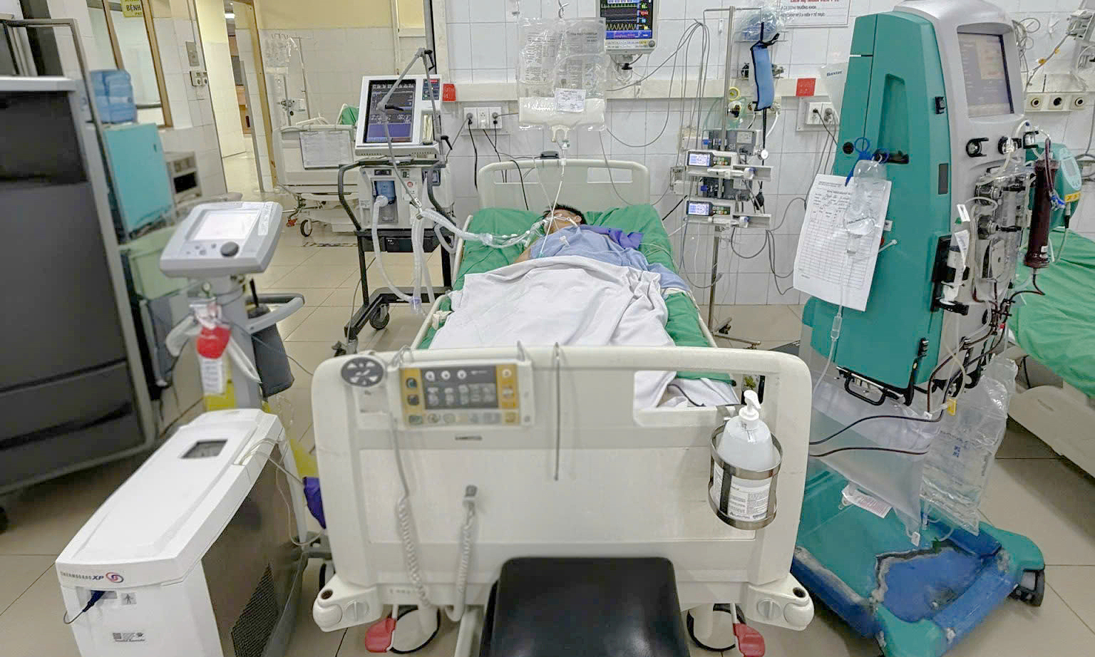 Sudden cardiac arrest during sports