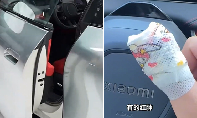 Xiaomi owner's finger broken by car door, company compensates with app points