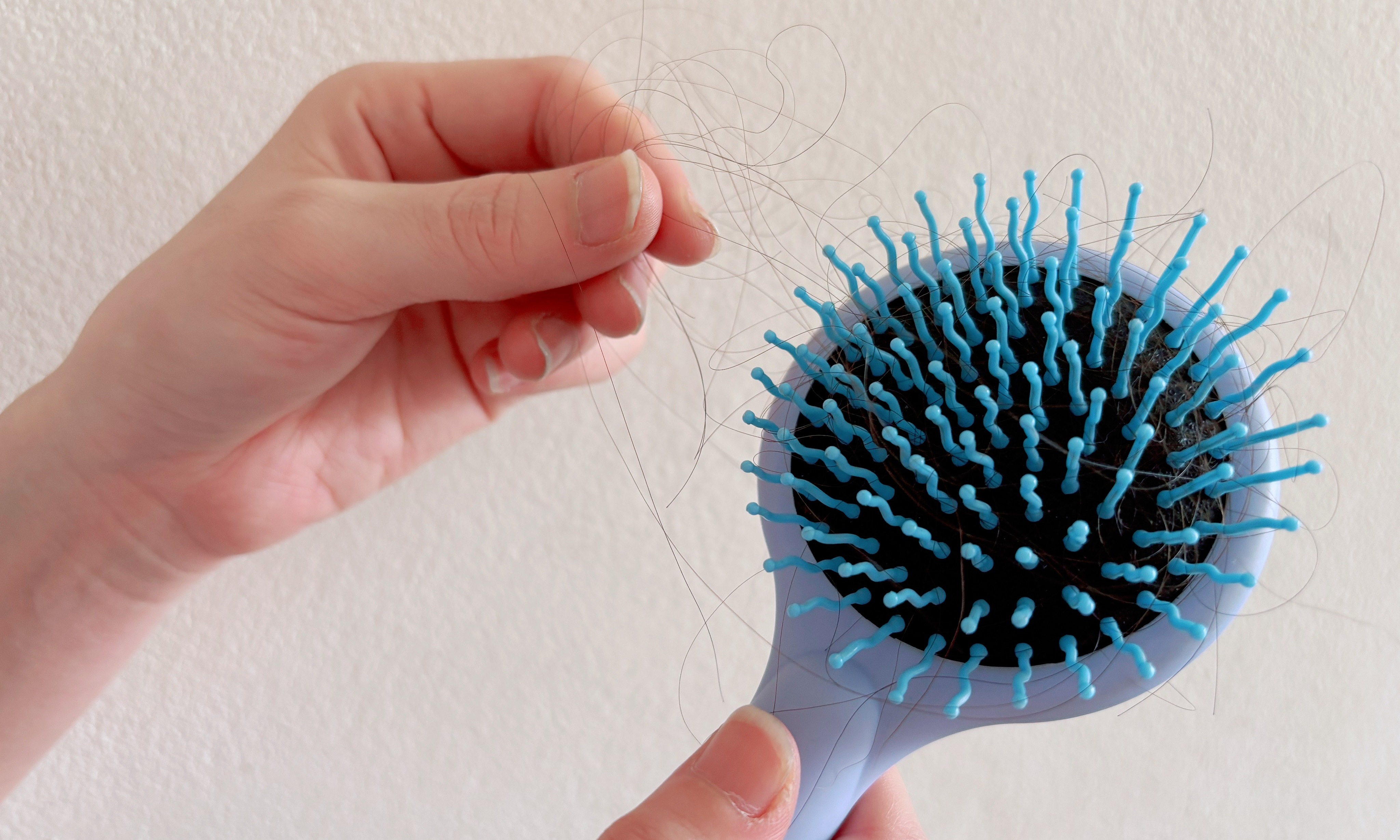 What nutrient deficiencies does significant hair loss warn of?