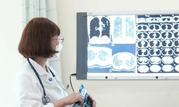 Preventing pulmonary tuberculosis transmission when living with an infected person