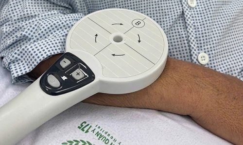 Why is recovery slow after a stroke, despite consistent rehabilitation?