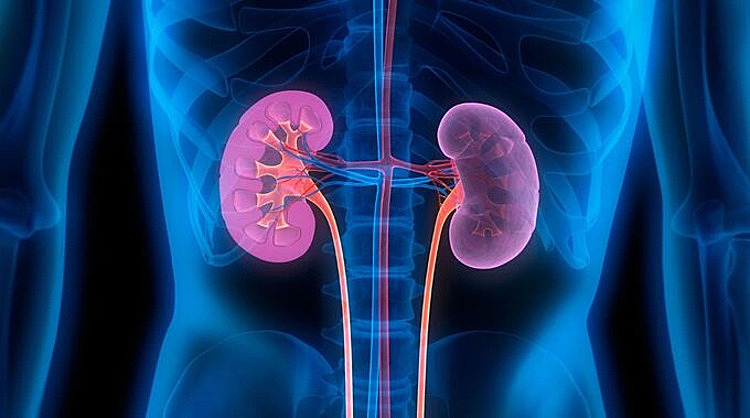 Kidney failure at 29