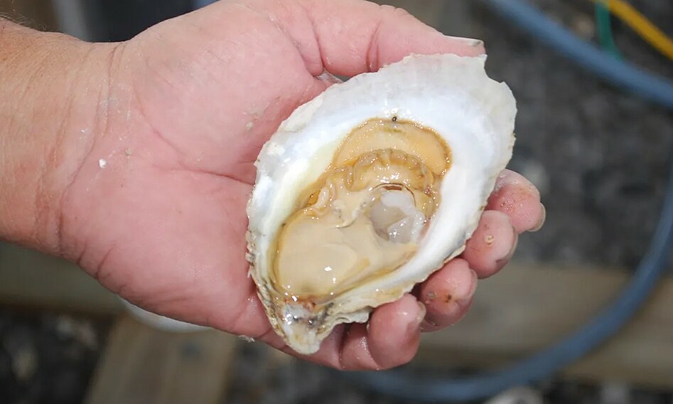 Acute kidney failure from bacterial infection after eating raw oysters