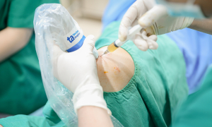 What conditions does joint injection treat?