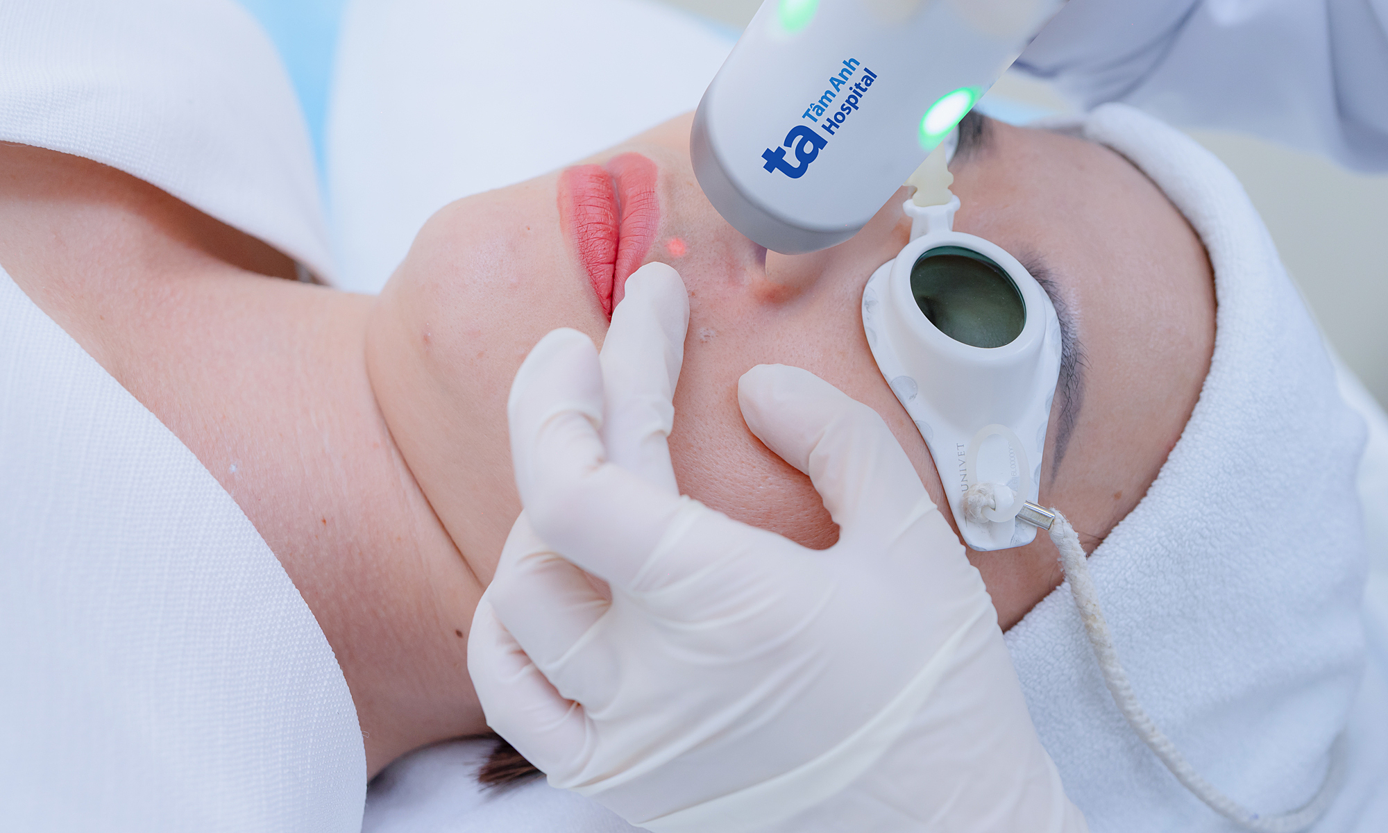 Can congenital telangiectasias be treated with laser?