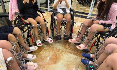 The dark side of China's underground leg-lengthening market