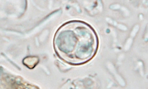 Mystery of a parasite spreading diarrhea in 17 U.S. states