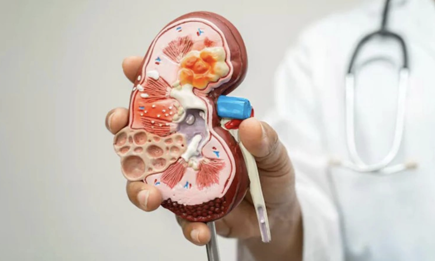 Taiwanese doctor highlights five warning signs from the kidneys