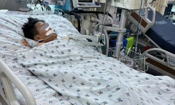 Two children in coma due to japanese encephalitis