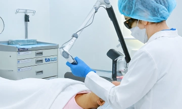 Laser treatment for melasma