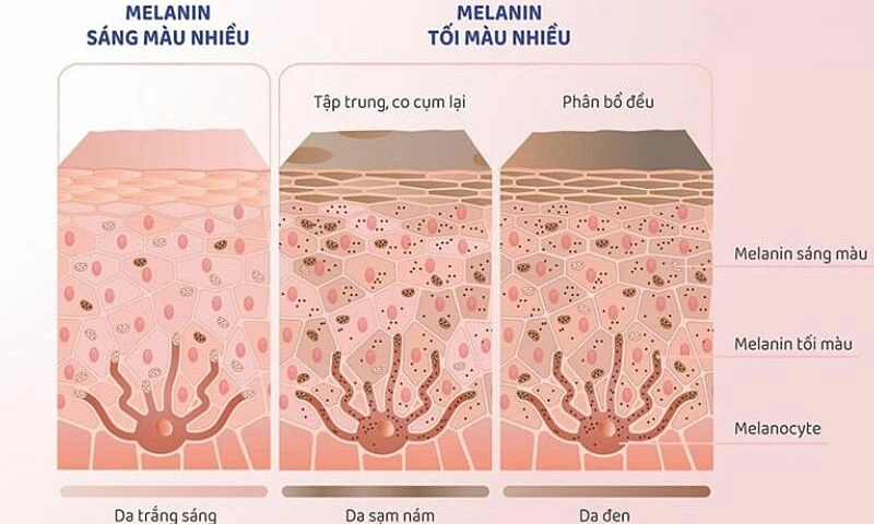 Three misconceptions about melanin