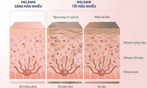Three misconceptions about melanin