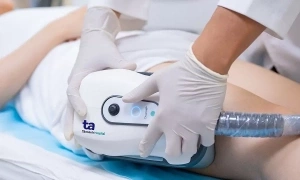 Can fat freezing technology be used on upper arms?