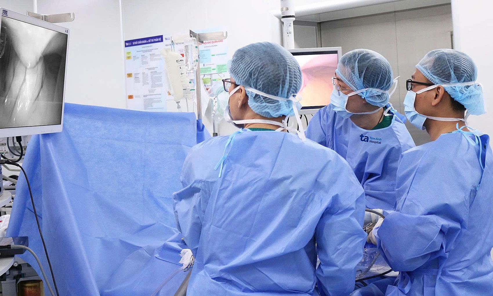Stones found along woman's pancreatic duct