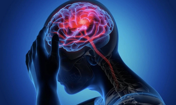 Stroke victim continued working, believing 'unconsciousness is the only sign'